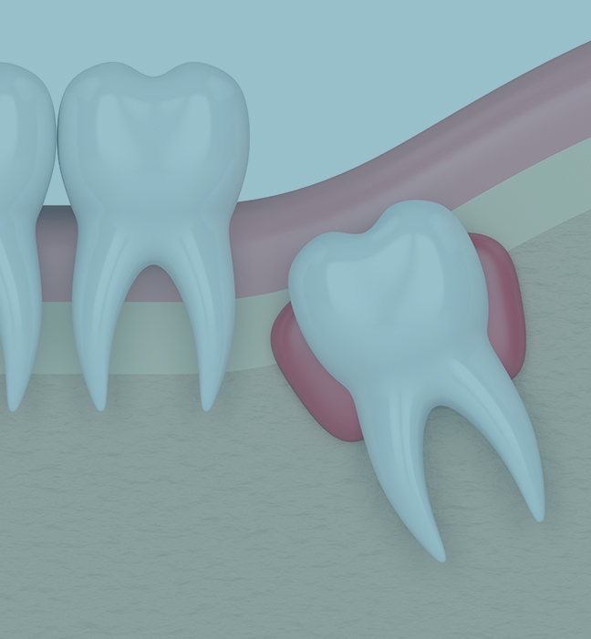 Treatment - Ash Lane Dental Suite